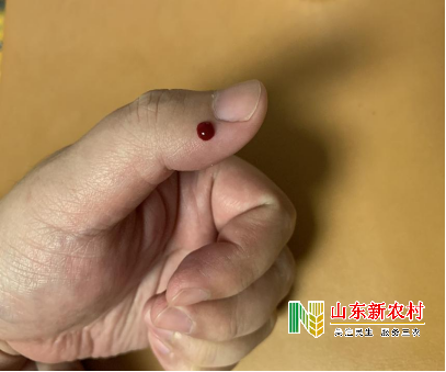 两个地方刺血，解决喉咙痛，还可以退烧